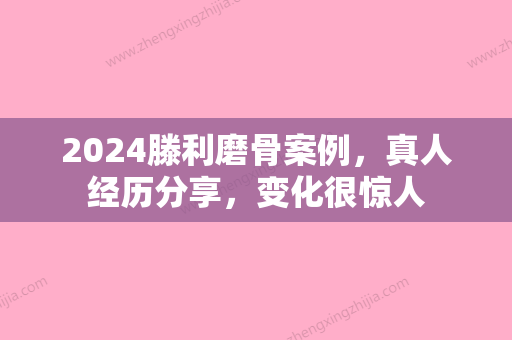 2024滕利磨骨案例，真人经历分享，变化很惊人