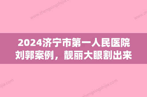 2024济宁市第一人民医院刘郭案例，靓丽大眼割出来！(济宁人民医院刘郭双眼皮案例)