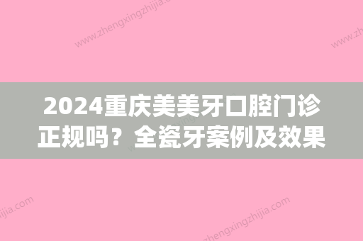 2024重庆美美牙口腔门诊正规吗？全瓷牙案例及效果图展示(重庆美连口腔)