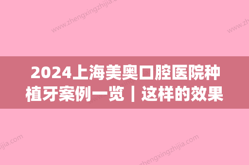 2024上海美奥口腔医院种植牙案例一览｜这样的效果我很喜欢(杭州美奥口腔医院种植牙齿好不好)