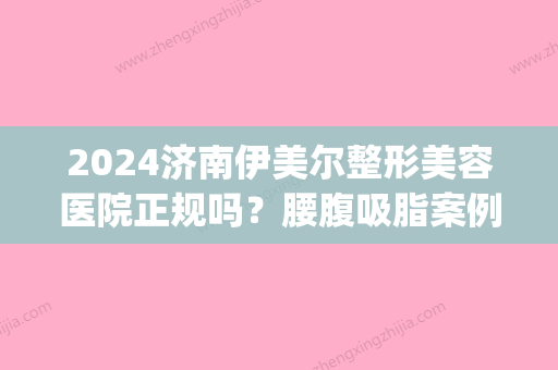 2024济南伊美尔整形美容医院正规吗？腰腹吸脂案例及效果图一览(伊美整形价格)