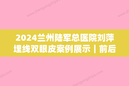 2024兰州陆军总医院刘萍埋线双眼皮案例展示｜前后变化让人惊讶(兰州陆军总院刘萍割双眼皮案例)