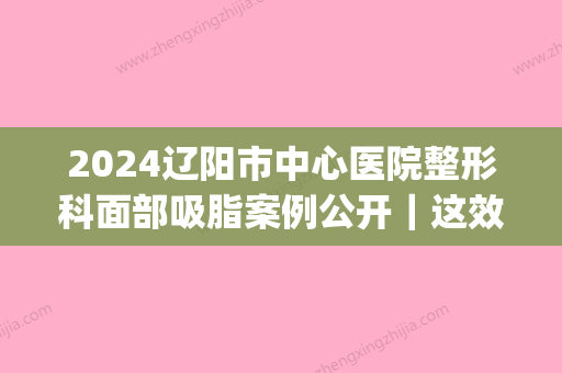 2024辽阳市中心医院整形科面部吸脂案例公开｜这效果让人惊讶(沈阳哪里做面部吸脂手术好)