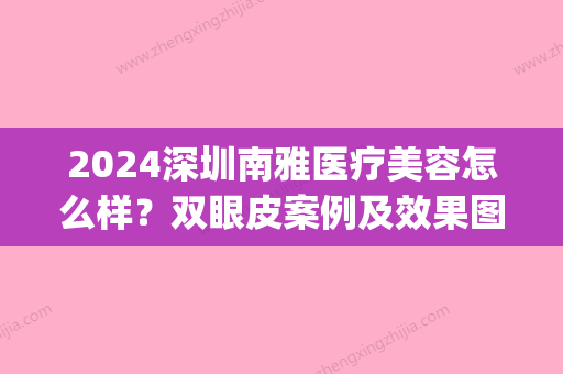 2024深圳南雅医疗美容怎么样？双眼皮案例及效果图公布(深圳南雅医疗美容门诊部怎么样)