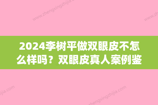 2024李树平做双眼皮不怎么样吗？双眼皮真人案例鉴赏，美极了(李树平双眼皮修复)