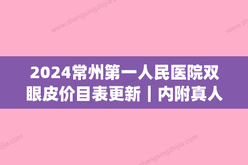 2024常州第一人民医院双眼皮价目表更新｜内附真人体验案例(常州第二人民医院割双眼皮)