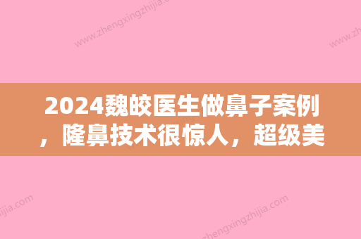 2024魏皎医生做鼻子案例，隆鼻技术很惊人，超级美腻