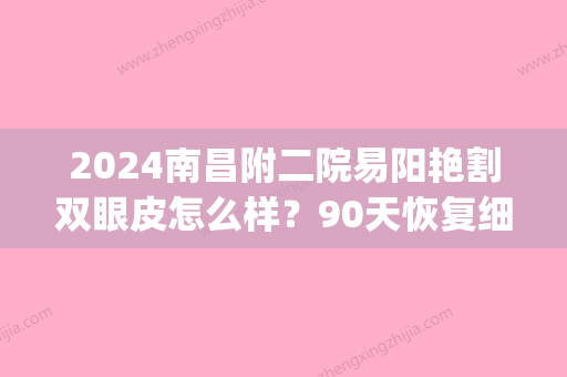 2024南昌附二院易阳艳割双眼皮怎么样？90天恢复细节图公布(南昌易阳艳做双眼皮怎么样)