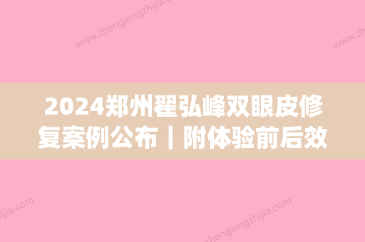 2024郑州翟弘峰双眼皮修复案例公布｜附体验前后效果图(翟弘峰做的双眼皮怎么样)