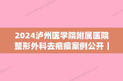 2024泸州医学院附属医院整形外科去疤痕案例公开｜附体验效果图(泸州祛疤医院)