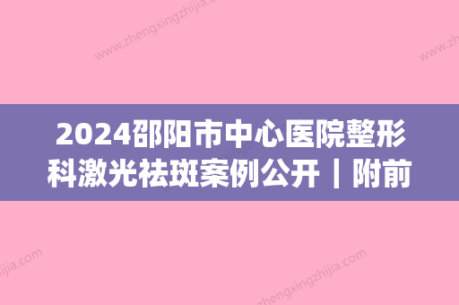 2024邵阳市中心医院整形科激光祛斑案例公开｜附前后对比图(邵阳市中心医院美容整形)