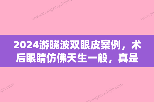 2024游晓波双眼皮案例，术后眼睛仿佛天生一般，真是美丽动人(于晓波修复双眼皮案例)