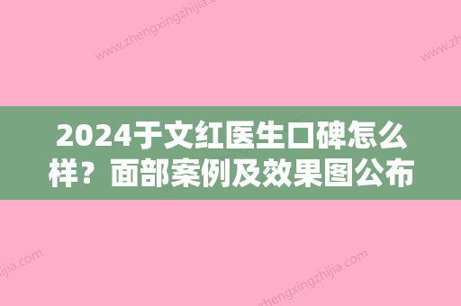 2024于文红医生口碑怎么样？面部案例及效果图公布