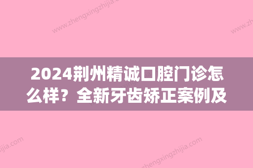 2024荆州精诚口腔门诊怎么样？全新牙齿矫正案例及效果图公布(荆州牙齿矫正价格表)