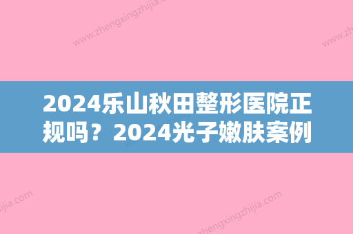 2024乐山秋田整形医院正规吗？2024光子嫩肤案例及效果图公布