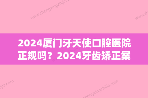 2024厦门牙天使口腔医院正规吗？2024牙齿矫正案例公布(厦门口腔医院矫正牙齿多少钱)