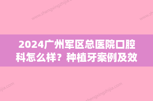 2024广州军区总医院口腔科怎么样？种植牙案例及效果图展示(广州医科大学附属口腔医院种植科)