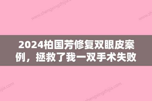 2024柏国芳修复双眼皮案例，拯救了我一双手术失败的眼