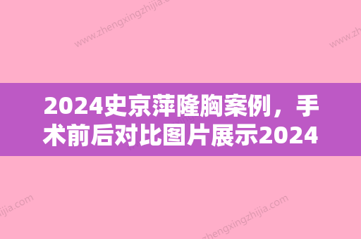 2024史京萍隆胸案例，手术前后对比图片展示2024