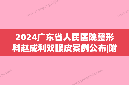 2024广东省人民医院整形科赵成利双眼皮案例公布|附价格表一览(赵成利双眼皮修复案例)