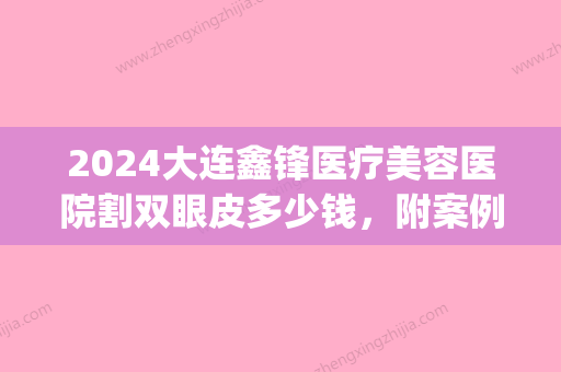 2024大连鑫锋医疗美容医院割双眼皮多少钱，附案例分享(双眼皮金鑫医生)