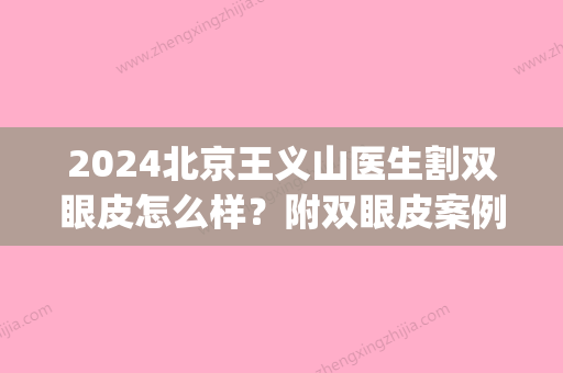 2024北京王义山医生割双眼皮怎么样？附双眼皮案例(北京王世勇割双眼皮怎么样)