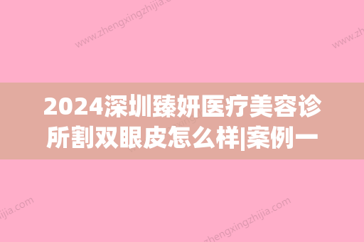 2024深圳臻妍医疗美容诊所割双眼皮怎么样|案例一览(臻妍医美 深圳)