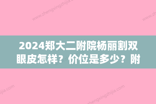 2024郑大二附院杨丽割双眼皮怎样？价位是多少？附案例鉴赏(郑大二附院双眼皮手术)