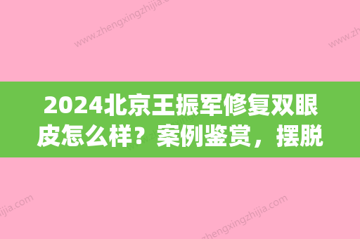 2024北京王振军修复双眼皮怎么样？案例鉴赏，摆脱失败阴影(王振军院长做双眼皮修复手术怎么样)