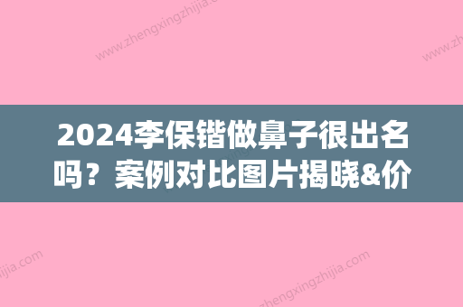 2024李保锴做鼻子很出名吗？案例对比图片揭晓&价格表(李保锴鼻子做得怎么样)