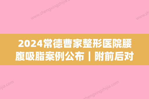 2024常德曹家整形医院腰腹吸脂案例公布｜附前后对比图(常德曹家整形价格表)