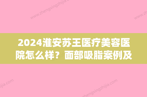 2024淮安苏王医疗美容医院怎么样？面部吸脂案例及效果图展示(淮安苏王整形美容医院)