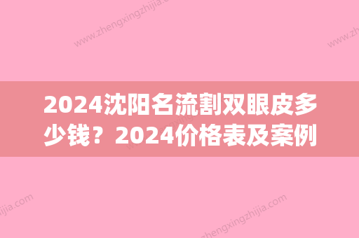 2024沈阳名流割双眼皮多少钱？2024价格表及案例展示(沈阳双眼皮整形)