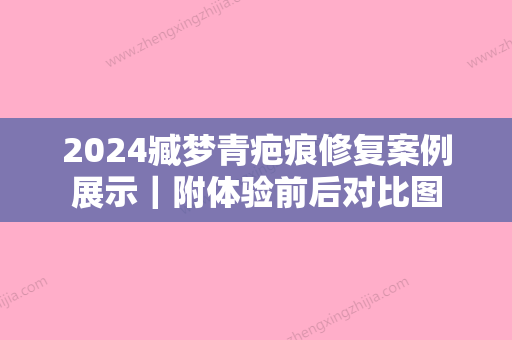 2024臧梦青疤痕修复案例展示｜附体验前后对比图