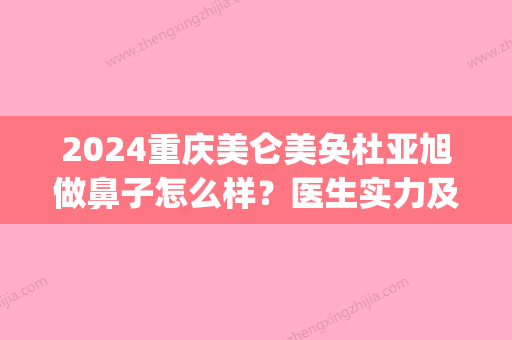 2024重庆美仑美奂杜亚旭做鼻子怎么样？医生实力及案例公布(重庆美仑美奂医生隆鼻怎么样)