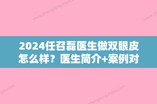 2024任召磊医生做双眼皮怎么样？医生简介+案例对比图片鉴赏