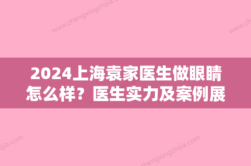 2024上海袁家医生做眼睛怎么样？医生实力及案例展示