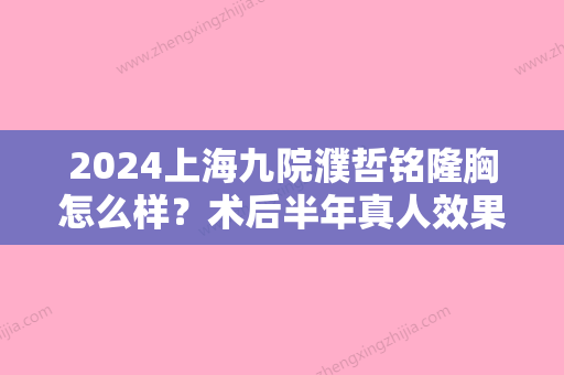 2024上海九院濮哲铭隆胸怎么样？术后半年真人效果展示