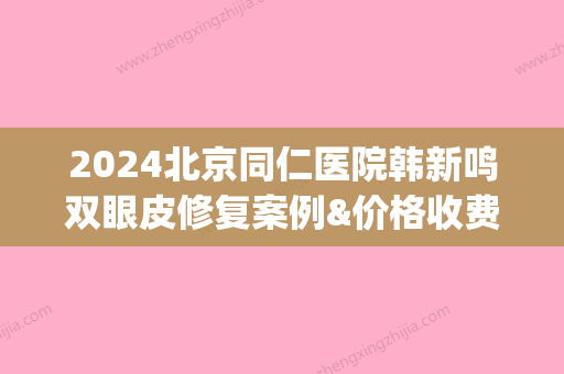 2024北京同仁医院韩新鸣双眼皮修复案例&价格收费标准一览(北京韩新鸣双眼皮怎么样)