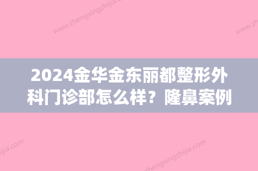 2024金华金东丽都整形外科门诊部怎么样？隆鼻案例及效果图一览(金华整型医院)