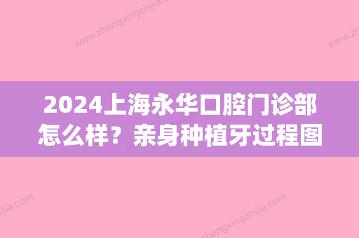 2024上海永华口腔门诊部怎么样？亲身种植牙过程图分享(上海永华口腔门诊部价格)