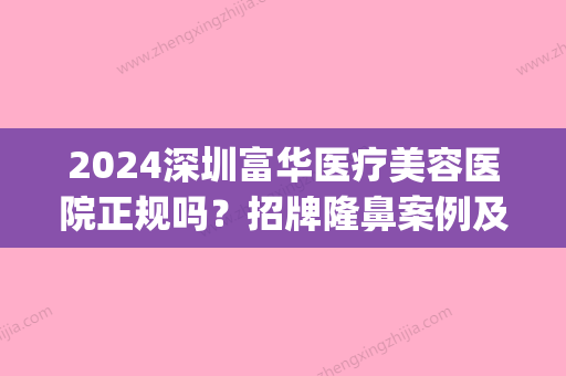 2024深圳富华医疗美容医院正规吗？招牌隆鼻案例及效果图分享(深圳富华做鼻子怎么样)