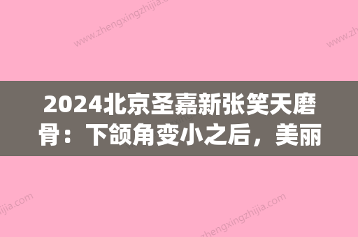 2024北京圣嘉新张笑天磨骨：下颌角变小之后，美丽提升~(磨骨圣嘉新张笑天磨骨)