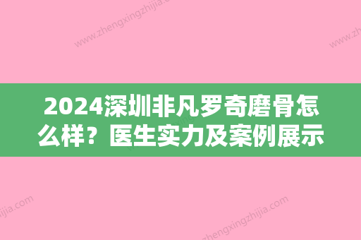 2024深圳非凡罗奇磨骨怎么样？医生实力及案例展示