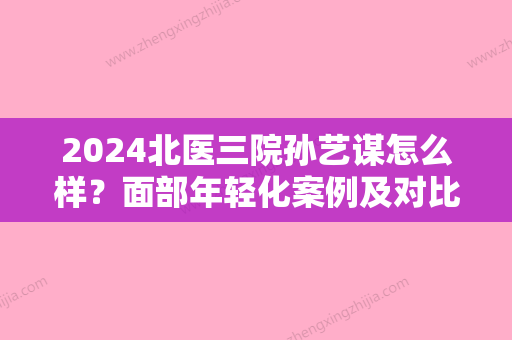 2024北医三院孙艺谋怎么样？面部年轻化案例及对比图公布