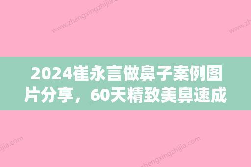 2024崔永言做鼻子案例图片分享，60天精致美鼻速成，闺蜜超羡慕(有没有永久的鼻子整形)