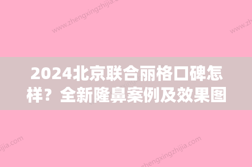 2024北京联合丽格口碑怎样？全新隆鼻案例及效果图展示(北京联合丽格双眼皮价格)