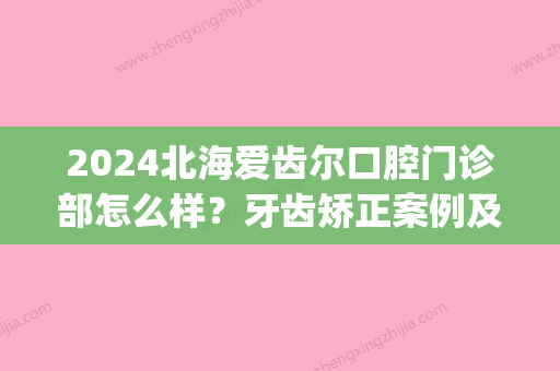 2024北海爱齿尔口腔门诊部怎么样？牙齿矫正案例及感悟一览(北海爱齿尔口腔的简介)