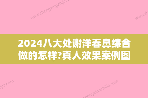 2024八大处谢洋春鼻综合做的怎样?真人效果案例图反馈