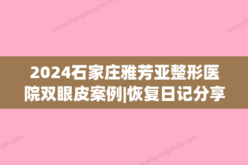 2024石家庄雅芳亚整形医院双眼皮案例|恢复日记分享~(石家庄雅芳亚隆鼻)